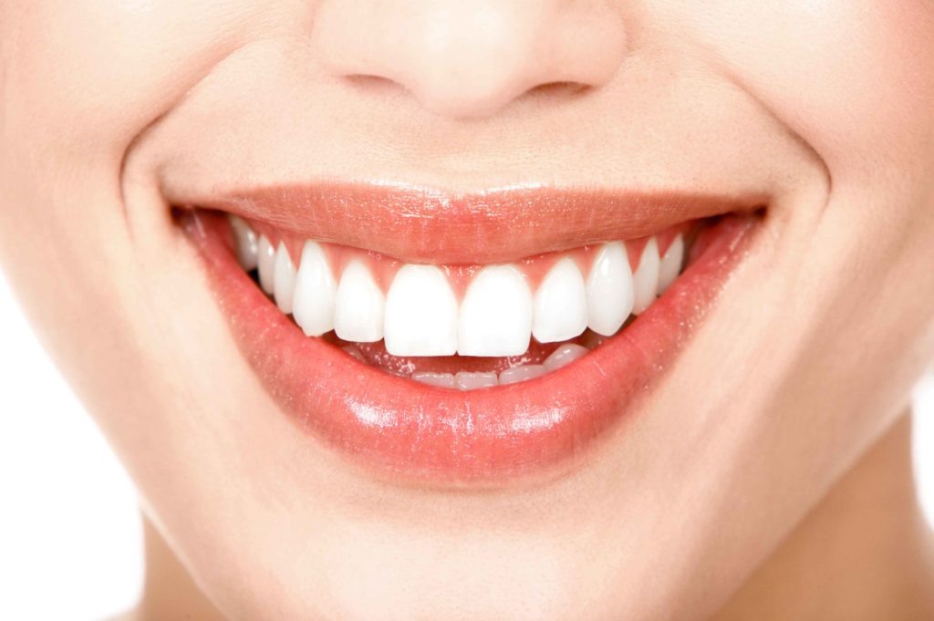 Portfolio 15 teeth whitening Athenacryo studios